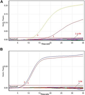 A Novel Real-Time Reverse Transcription Loop-Mediated Isothermal Amplification Detection Platform: Application to Diagnosis of COVID-19